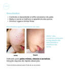 Creamy Skincare Ácido Salicílico 90ml – Linhas Finas Amenizadas, Cravos Reduzidos e Oleosidade Controlada – Uso Diurno e Noturno